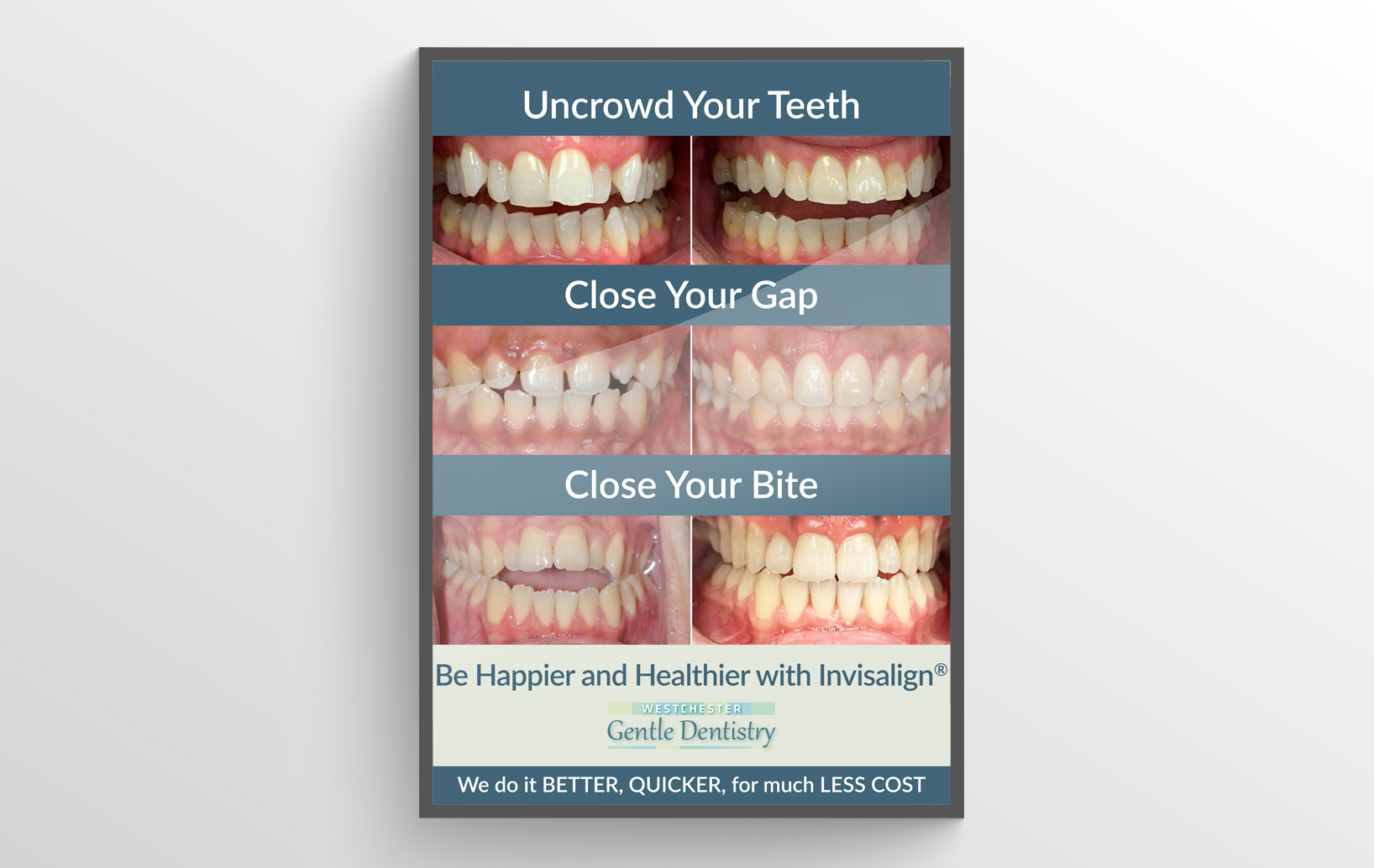 Invisalign Marketing Poster